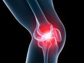 Osteoarthritis of the knee joint causes knee pain