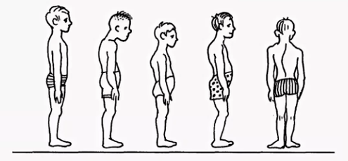 A violation of posture