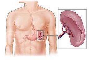 Spleen pathology as the cause of pain under the left shoulder blade